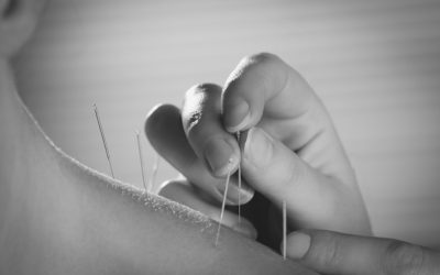 Acupuncturists is what we’re called….